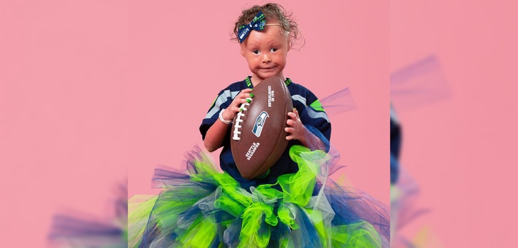 Niña con raro trastorno que afecta su piel debuta como modelo: buscan redefinir la noción de belleza