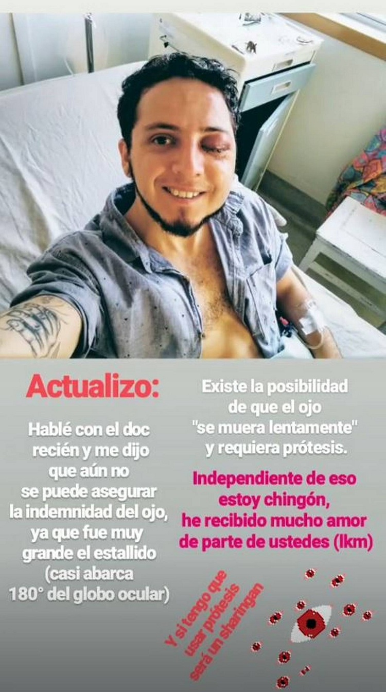 Daniel Lastra | Instagram