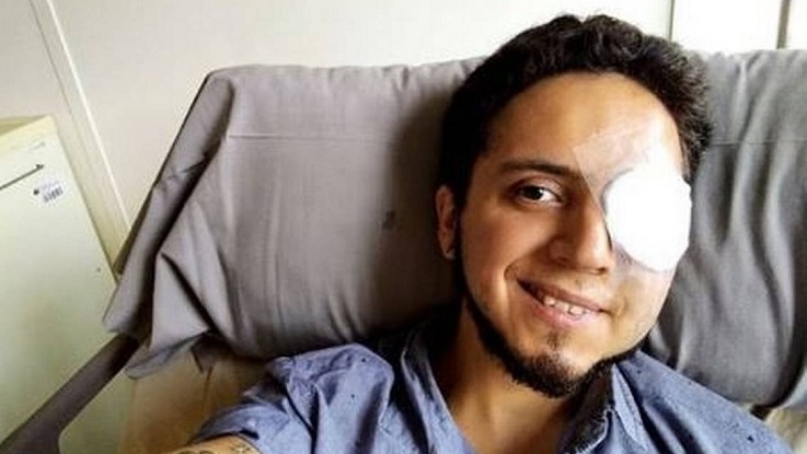 Joven que perdió la visión en ojo durante Año Nuevo en Plaza Italia: 