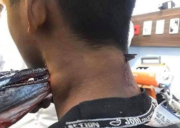 pez aguja cuello niño