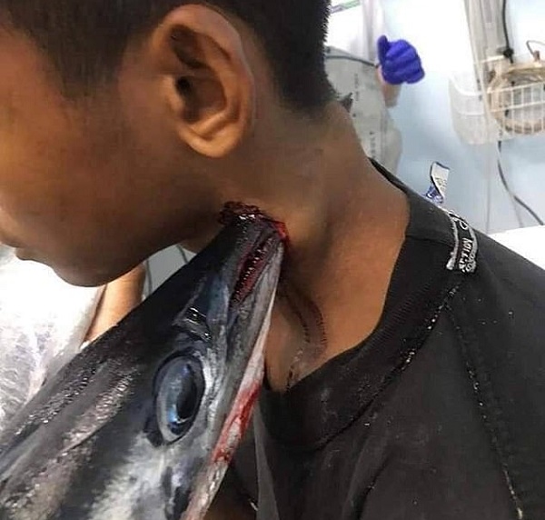 pez aguja niño indonesia