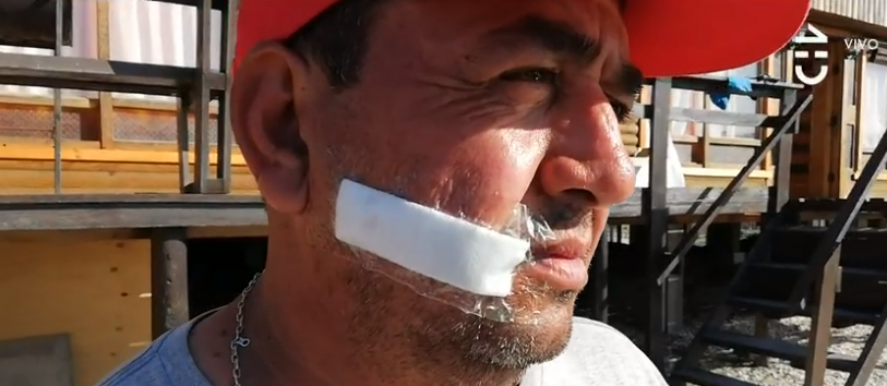 Hombre terminó con 20 puntos en su cara por ataque de carro lanza aguas: estaba dentro de peluquería