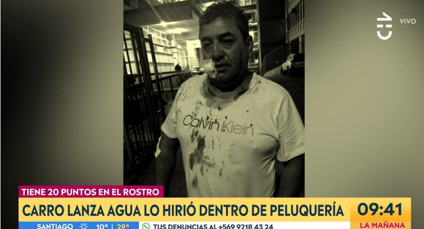 Hombre terminó con 20 puntos en su cara por ataque de carro lanza aguas