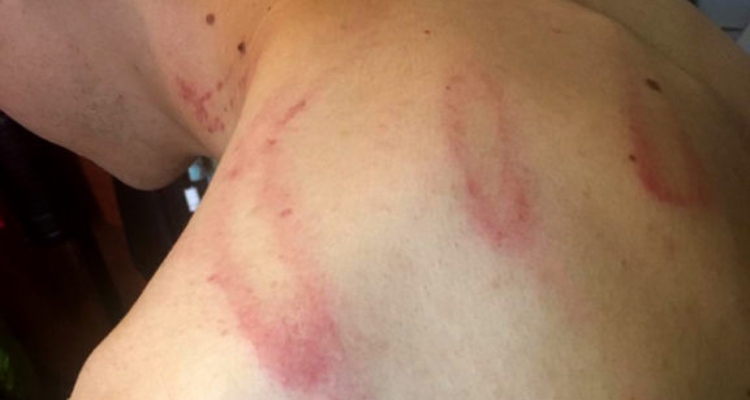 Familia de joven golpeado por Carabineros entrega nuevos antecedentes: INDH se querella por torturas