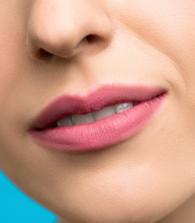 ¿Tienes manchas en la zona del bozo?: conoce la causa, prevención y tratamiento