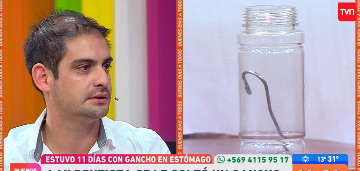 Hombre denunció negligencia en clínica dental: se tragó gancho de seis centímetros en procedimiento