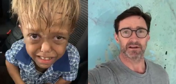 Niño con enanismo sufre bullying y madre grabó estremecedor video: Hugh Jackman le dedicó palabras