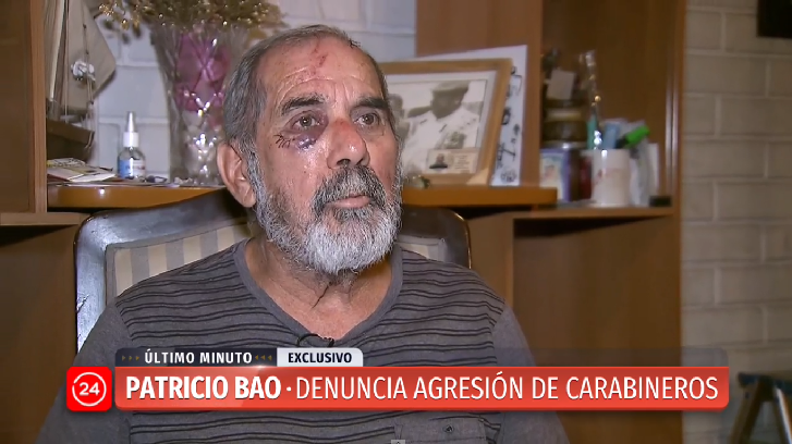 Patricio Bao y agresión de Carabineros