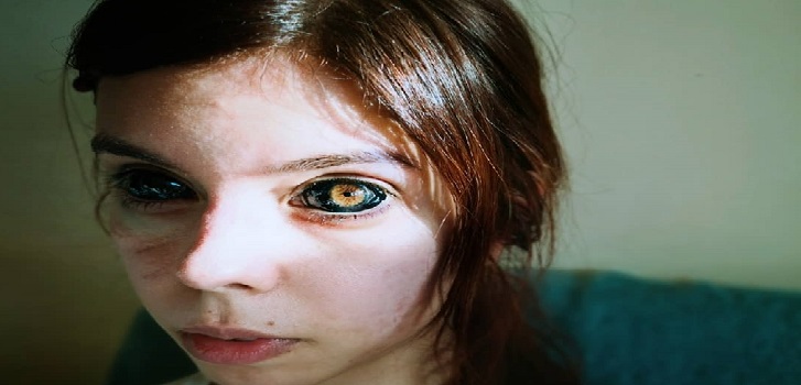 Modelo polaca se tatuó los ojos de color negro y quedó ciega: intentó imitar a su artista favorito