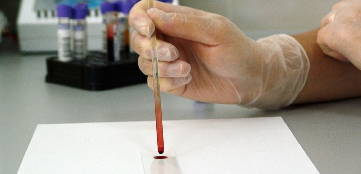 Confirman segundo caso mundial de curación de VIH: es un paciente de Venezuela