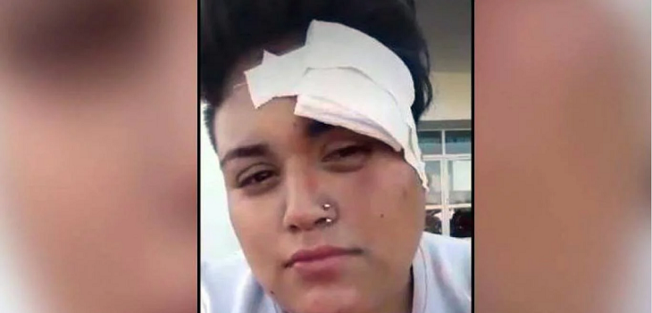 Brutal ataque lesbofóbico en Argentina: cinco hombres la golpearon hasta dejarla en el piso