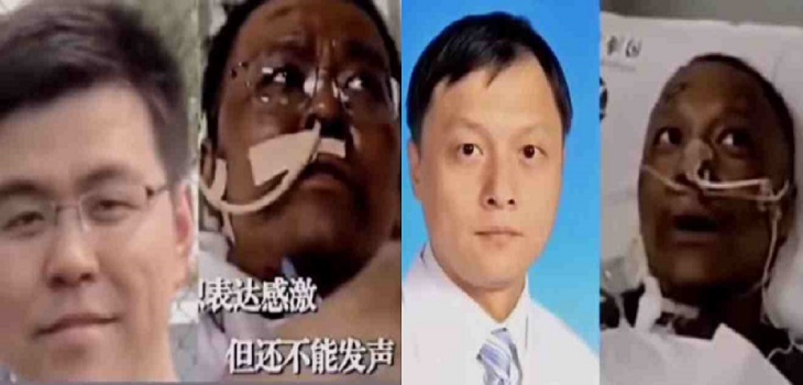 Insólito: a dos médicos chinos se les oscureció la piel tras recuperarse de COVID-19