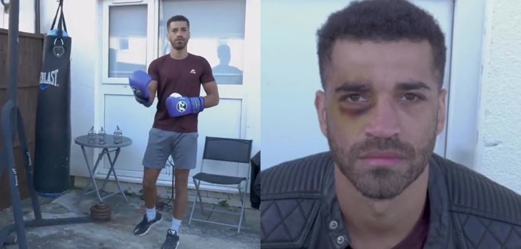 Campeón de boxeo sufrió tremendo fail mientras grababa clase para sus redes: se golpeó a sí mismo