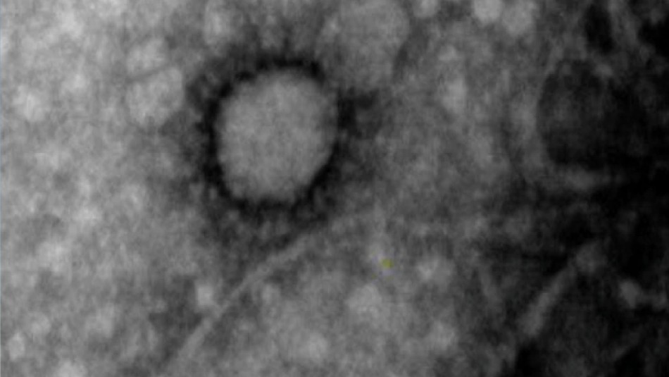 Divulgan la primera foto del coronavirus que circula en Argentina: 