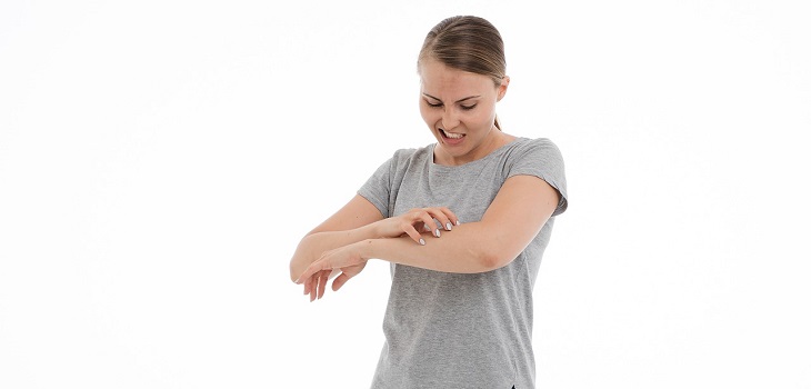 Conoce los cinco síntomas que puede causar el COVID-19 en la piel: se da en 20% de los pacientes