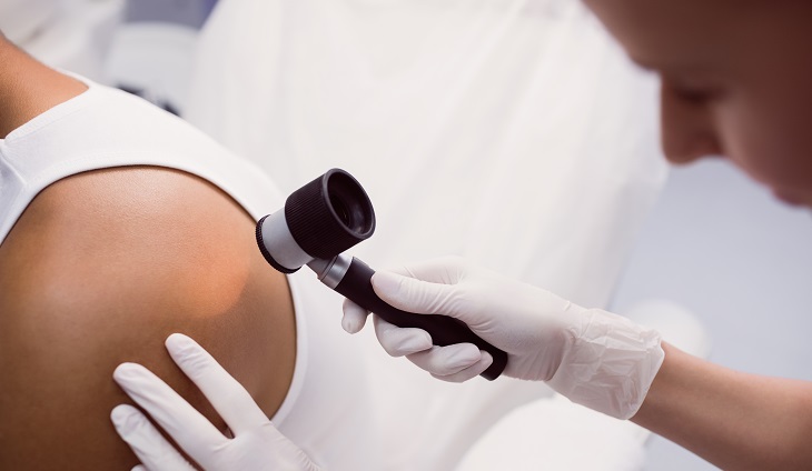 Cómo eliminar un lunar de carne