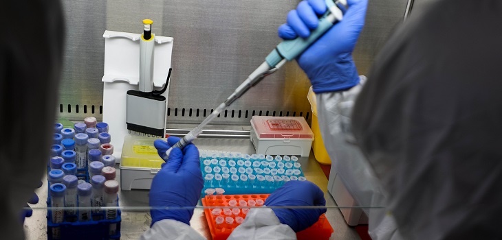 PCR por saliva para COVID-19: ¿en qué consiste el nuevo examen anunciado por el Minsal?