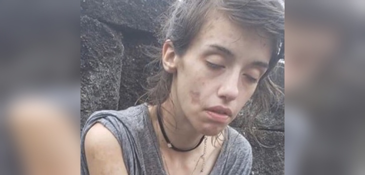 Joven que superó su adicción a las drogas mostró su increíble transformación: 