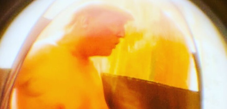 ¿Foto viral de Donald Trump desnudo bronceándose? No, no es lo que parece