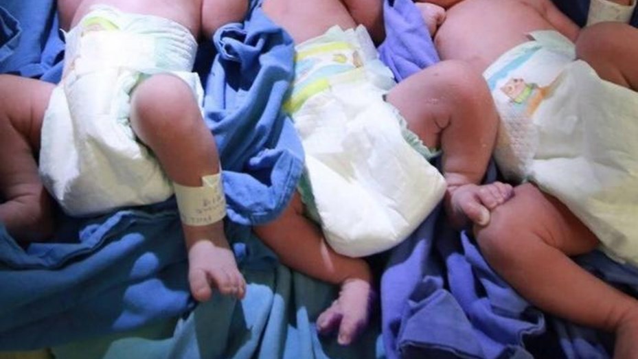 Caso 'inédito' en México: nacen trillizos de manera prematura y dan positivo por coronavirus