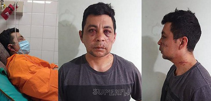 Quedó inconsciente y quemaron su casa: brutal golpiza recibió un enfermero recuperado de COVID-19