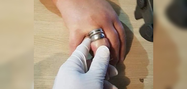 Mujer casi pierde el dedo por anillo atorado: voluntarios de bomberos evitaron una tragedia