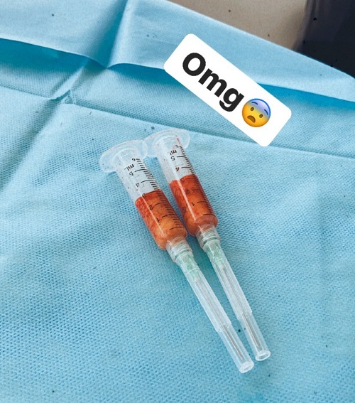 christell rodriguez bichectomia