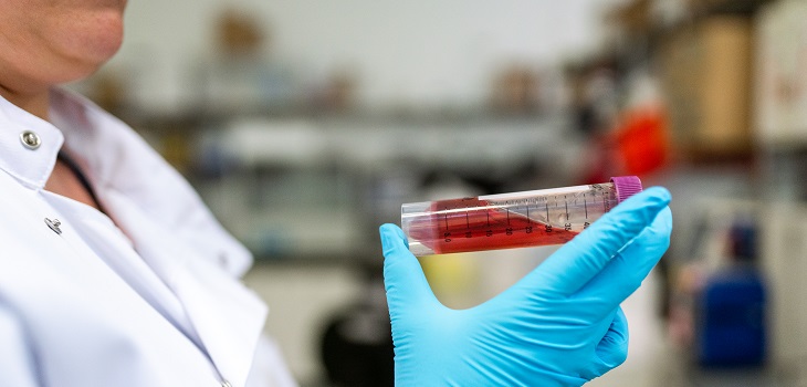 Examen de sangre permitiría detectar cáncer 4 años antes de ser diagnosticado en método convencional