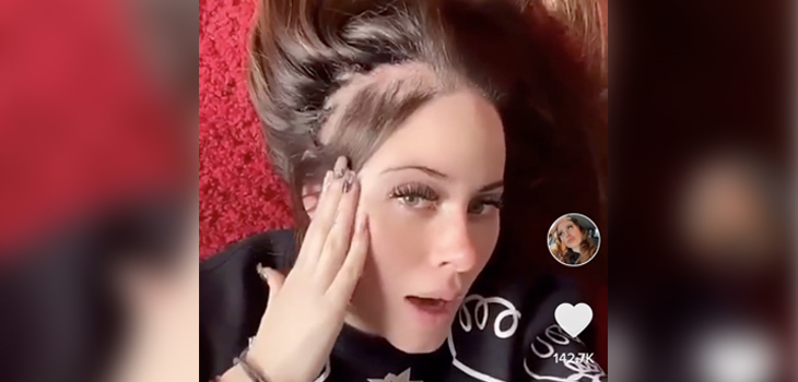 Ignacia Michelson mostró las consecuencias de sufrir alopecia desde niña: 