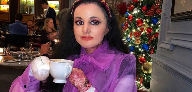 La inspiradora historia de Myra Ali, la periodista inglesa que sufre de 