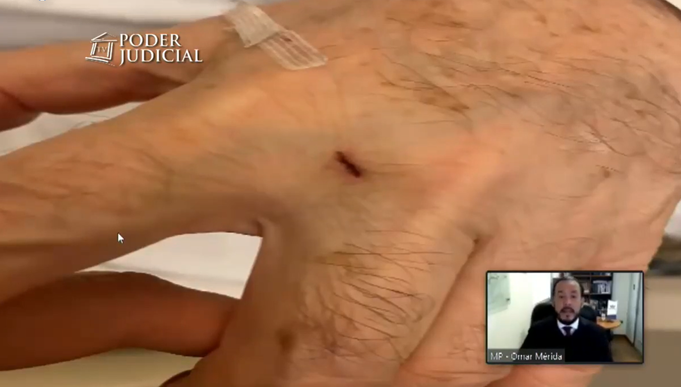 Fiscalía pide prisión preventiva para 'Nano' Calderón por parricidio frustrado contra su padre