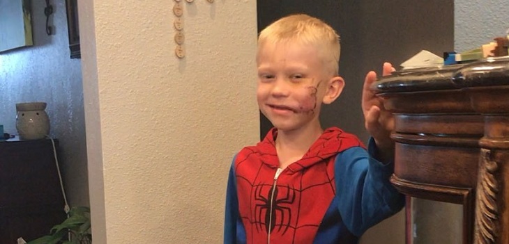 Niño que salvó a su hermana del ataque de un perro inició reto viral para encontrar a otros 