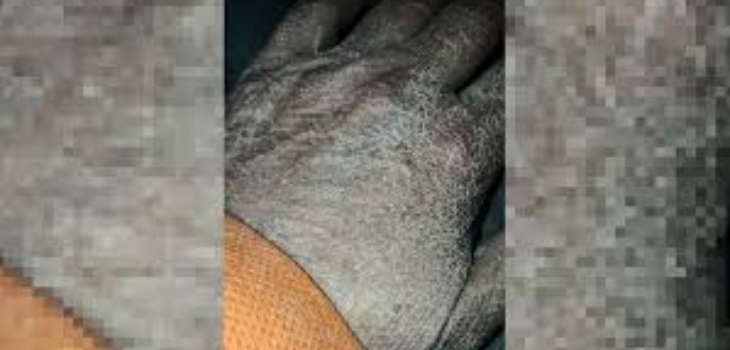 La dramática publicación de las manos de una enfermera tras una jornada combatiendo el COVID-19