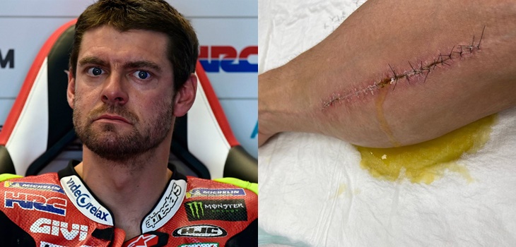 ¿Verías los músculos de tu brazo en movimiento? Piloto mostró impactantes fotos de su operación