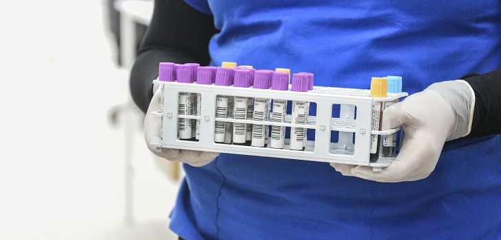 Confirman una nueva cepa del coronavirus en Reino Unido que se está extendiendo de manera acelerada