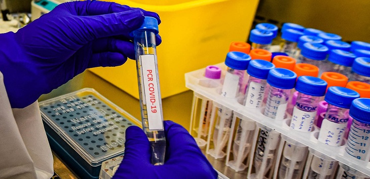 Minsal pone en marcha disminución de cuarentena obligatoria para casos leves y probables de COVID-19