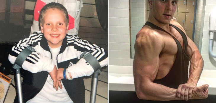 La increíble historia de hombre al que le dijeron que no podría caminar: hoy es entrenador fitness