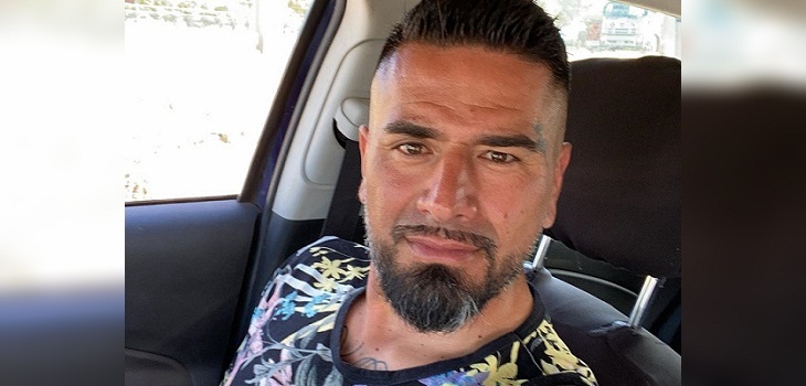 Kike Acuña se sometió a tratamiento con botox y transmitió por redes: 