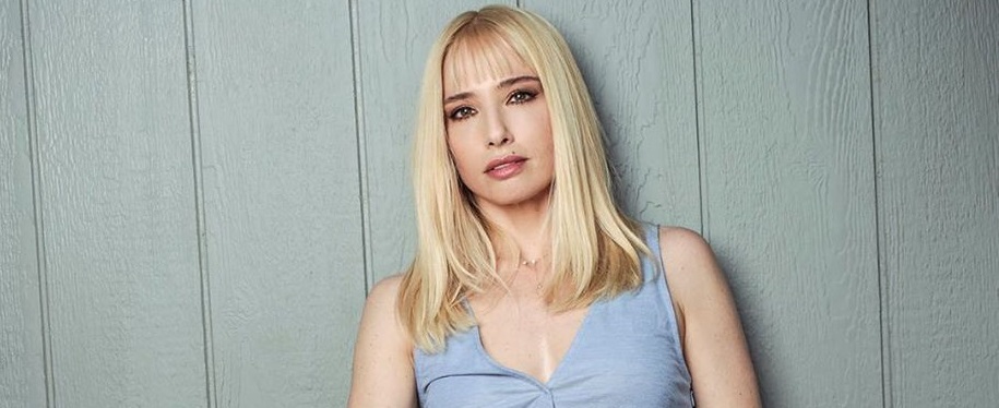 Mane Swett mostró los efectos de la psoriasis en su cuerpo para concientizar sobre la enfermedad