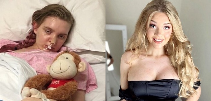 Joven inglesa que fue diagnosticada por error con enfermedad cerebral ahora se luce como modelo