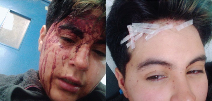Movilh denuncia que joven trans fue golpeado en San Bernardo hasta quedar inconsciente
