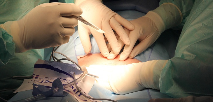 Médico deberá indemnizar con $712 millones a paciente que quedó con secuelas tras cirugía