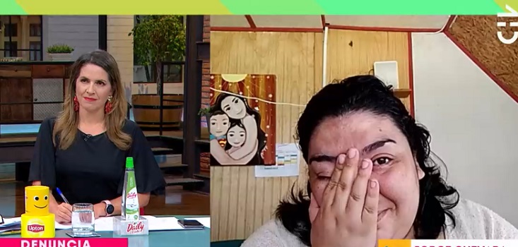 Mujer que fue atacada con un hacha en su cabeza recibió positiva sorpresa en vivo en matinal de CHV
