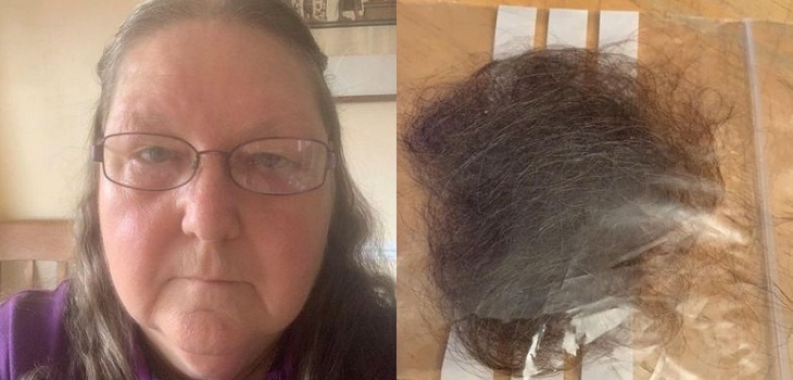 Inglesa fue diagnosticada con COVID-19 y experimentó pérdida de su cabellera: 