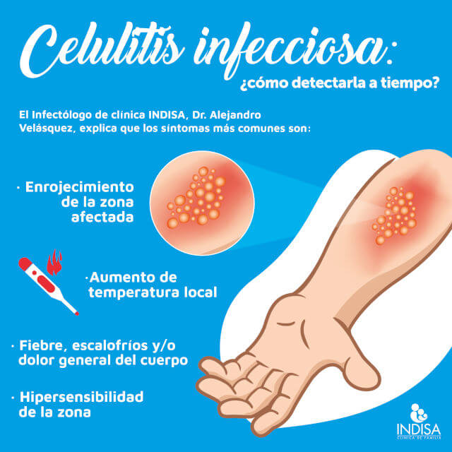 qué es la celulitis