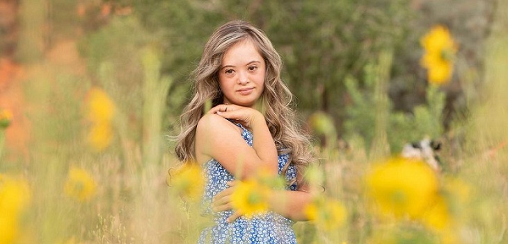 La inspiradora historia de Kennedy, joven con síndrome de Down que rompe barreras en el modelaje