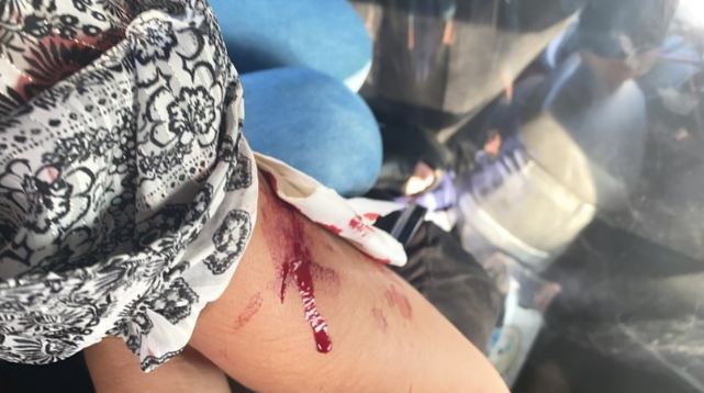 filtran imágenes del brazo de notera del Buenos días a todos