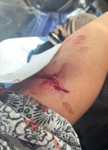 filtran imágenes del brazo de notera del Buenos días a todos