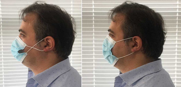 Debes dejar de hacerlo: expertos advierten el peligro de cruzar elásticos de las mascarillas