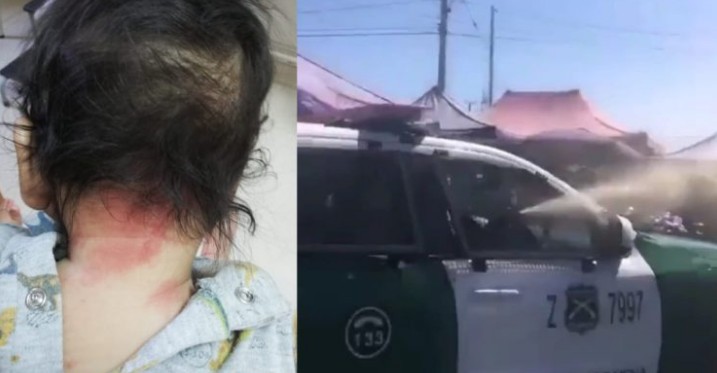 Defensoría de la niñez presentó denuncia contra Carabineros por uso de gas pimienta en Bajos de Mena